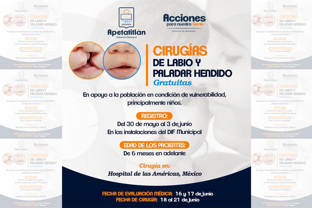Con cirugías gratuitas atenderán a menores con labio y paladar hendido en Apetatitlán